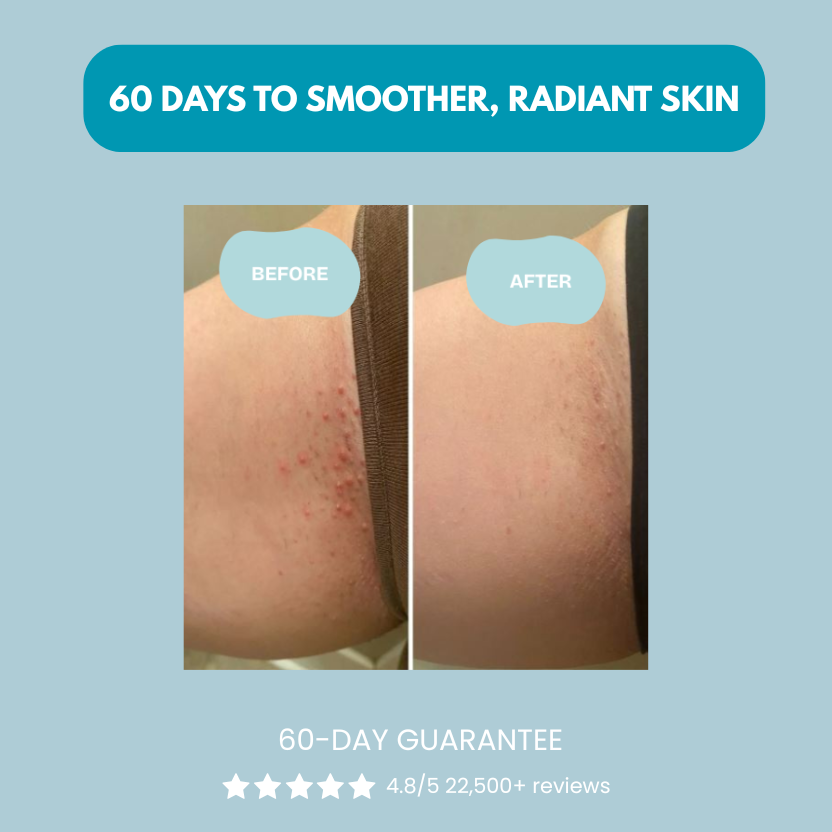 Serniwell Ingrown Hair Treatment