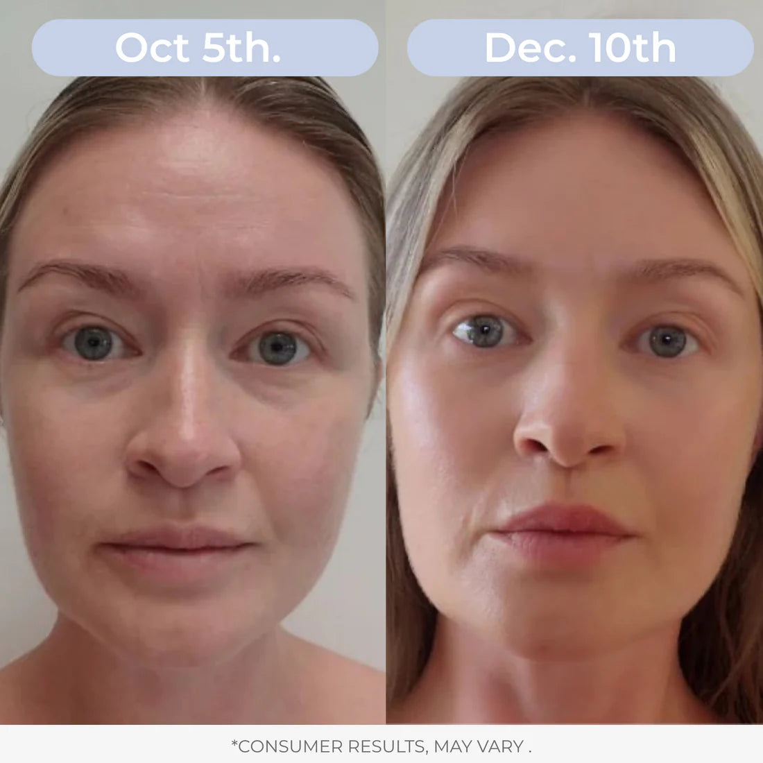 Serniwell Liposomal Glutathione